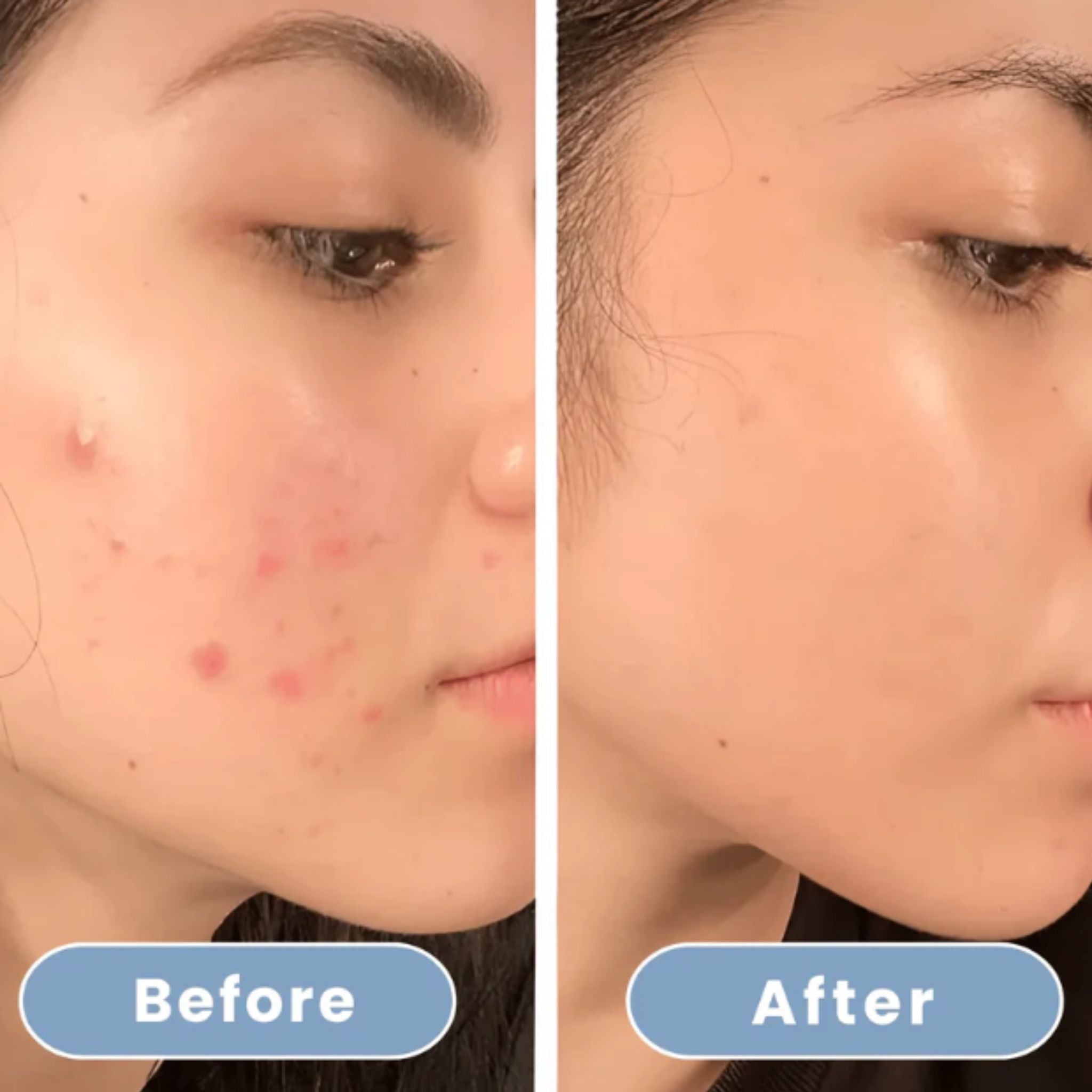 HydroLuxe Shower – For Radiant Skin and Salon-Soft Hair, Every Day