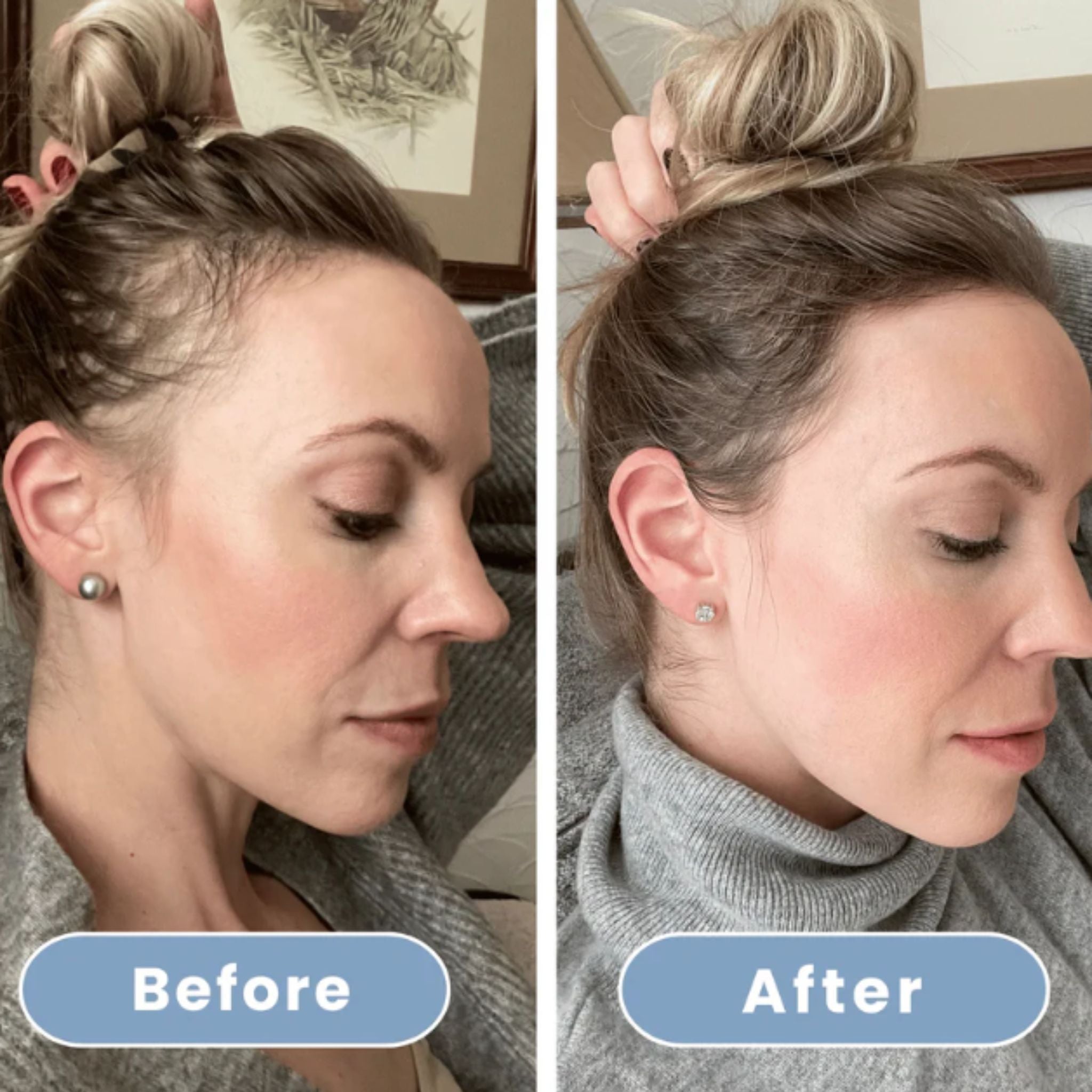 HydroLuxe Shower – For Radiant Skin and Salon-Soft Hair, Every Day