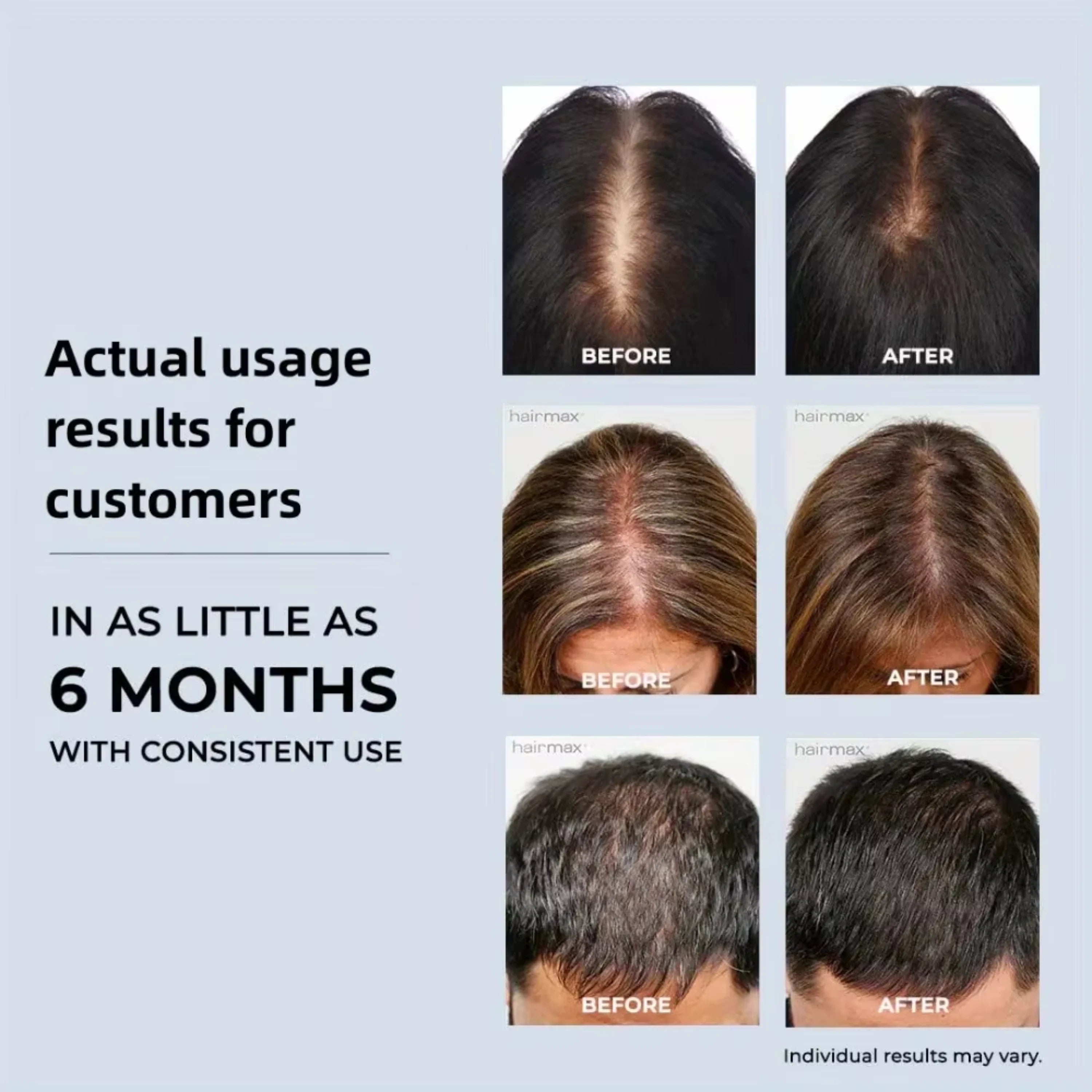 GrowGlow – Red Light Therapy Cap for Hair Regrowth
