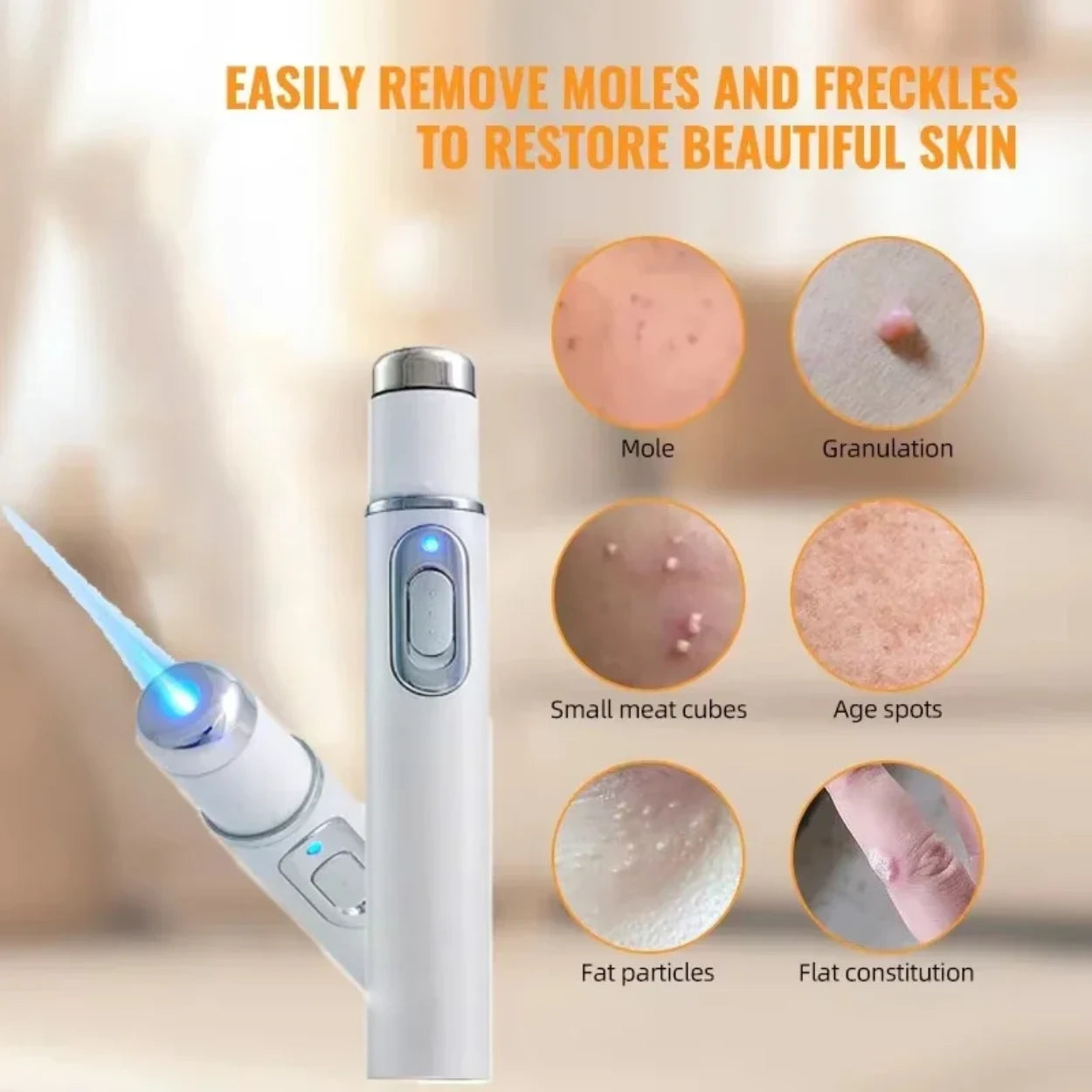 Glowzen - Laser Mole & Skin Tag Remover