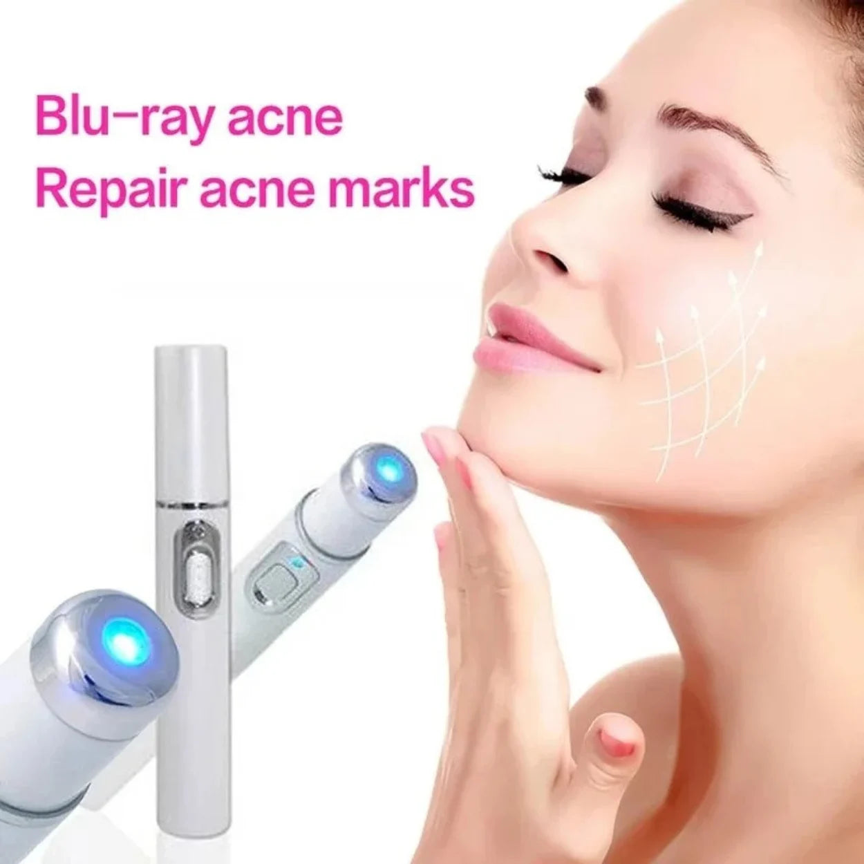 Glowzen - Laser Mole & Skin Tag Remover